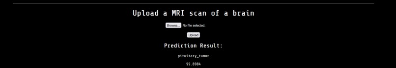 CNN based brain tumor diagnosis – screenshot 2
