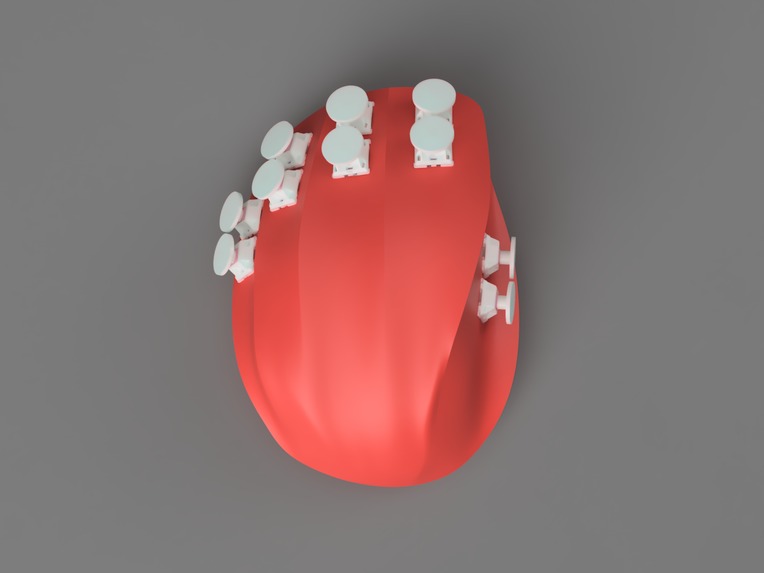 SwiftSpeak – screenshot 1