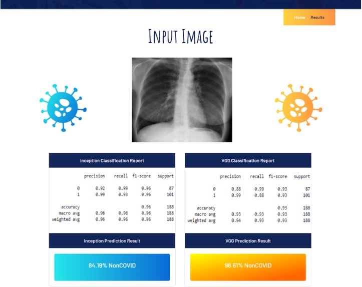 Covid-19 Detection  – screenshot 2