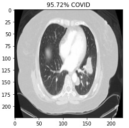Covid-19 Detection  – screenshot 15