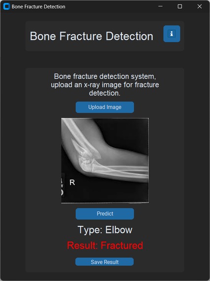 Beginner-Hackathon : AI_fracture_Detection – screenshot 7