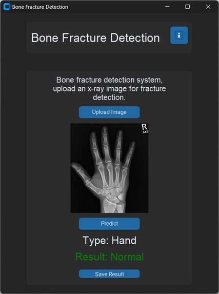 Beginner-Hackathon : AI_fracture_Detection – screenshot 6