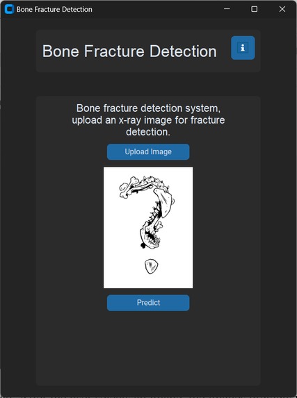 Beginner-Hackathon : AI_fracture_Detection – screenshot 4