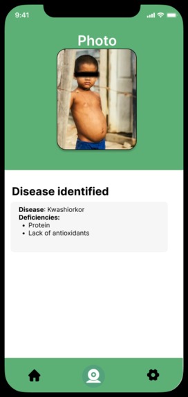 NutriVision – screenshot 1