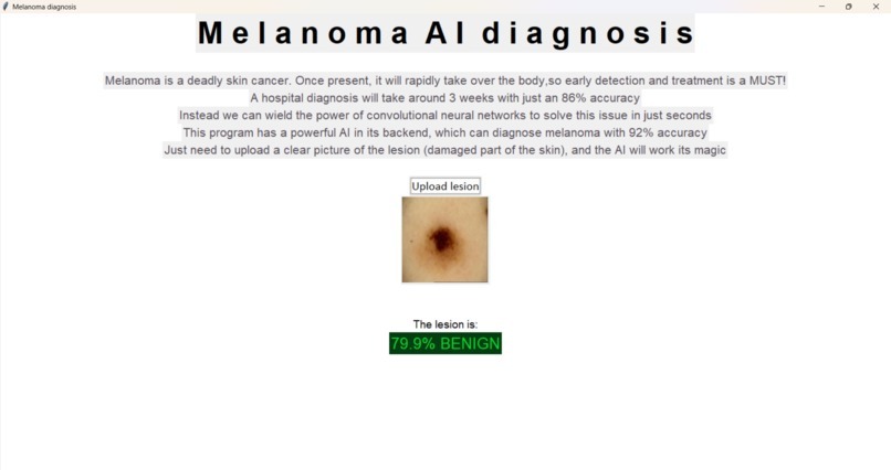 Skin Cancer AI diagnosis – screenshot 2