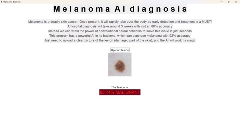 Skin Cancer AI diagnosis – screenshot 5