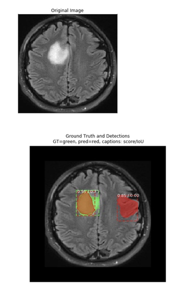 BrainScan Tumour Detector – screenshot 1