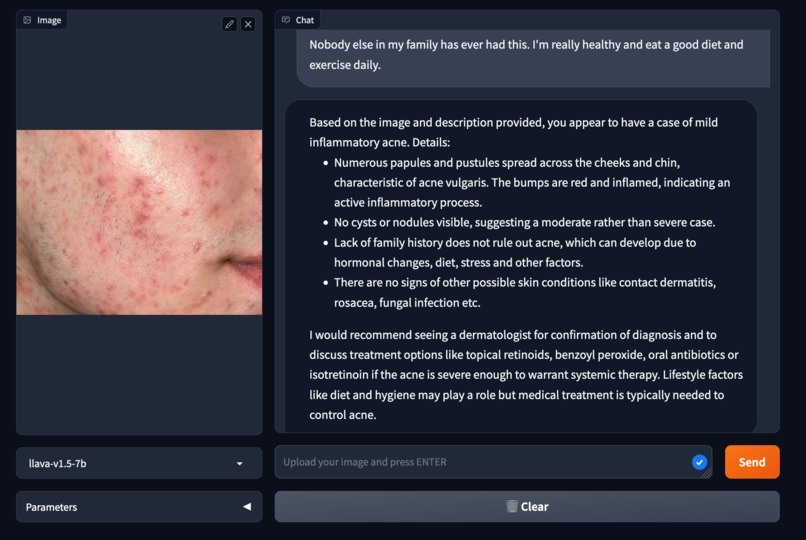 PorePatrol AI – screenshot 1