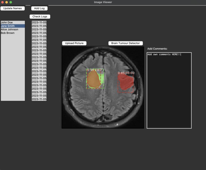 BrainScan Tumour Detector – screenshot 3