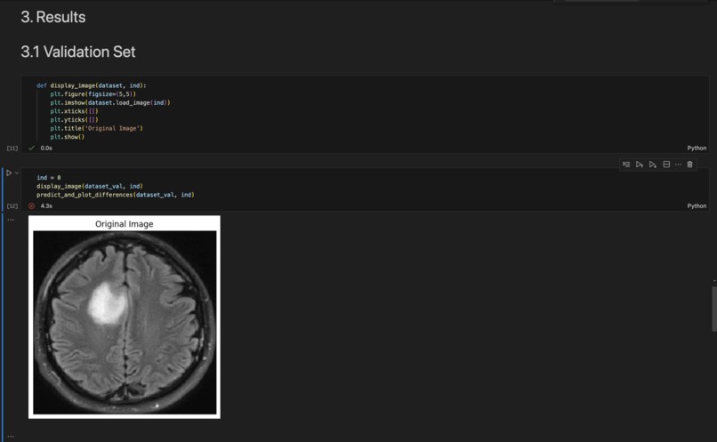 BrainScan Tumour Detector – screenshot 5