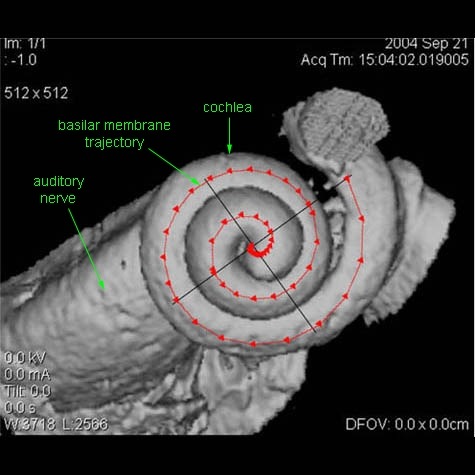 Simulated Auditory Evoked Hemodynamics – screenshot 1