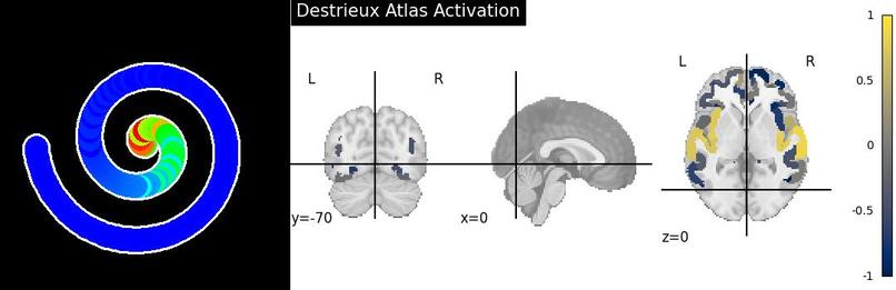 Simulated Auditory Evoked Hemodynamics – screenshot 4