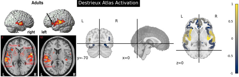 Simulated Auditory Evoked Hemodynamics – screenshot 3