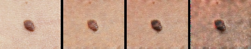 CanT-cer – screenshot 1