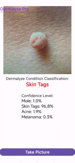 Dermalyze Pro – screenshot 4