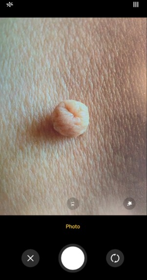 Dermalyze Pro – screenshot 3