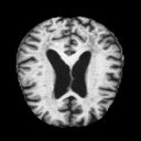 Alzheimer Detector – screenshot 1