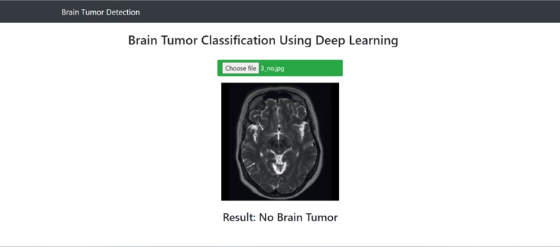 Brain Tumor Detection – screenshot 2