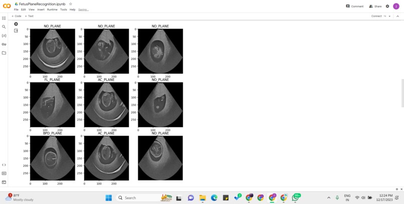 PregNomaly Detection – screenshot 2