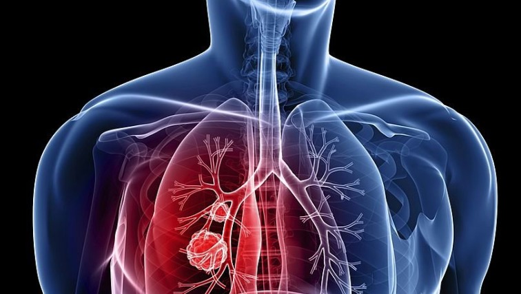 Best Cancer Hospital in Chennai | Cancer Hospital in Chennai – screenshot 1