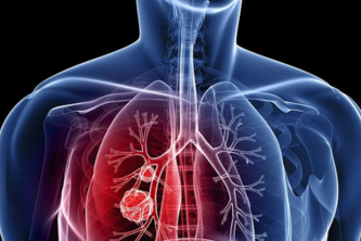 Best Cancer Hospital in Chennai | Cancer Hospital in Chennai