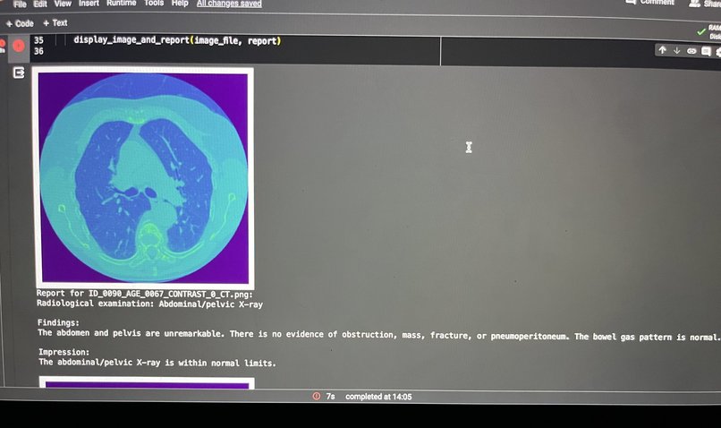 AI Radiologist – screenshot 1