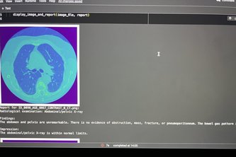 AI Radiologist