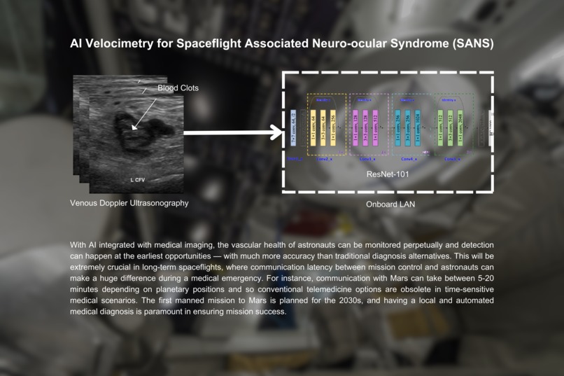 AI Velocimetry for Space Assoc. Neuro-ocular Syndrome (SANS) – screenshot 1