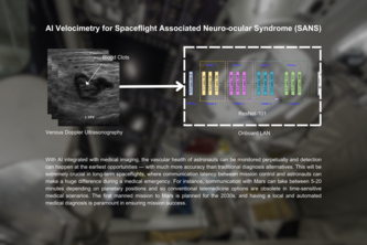 AI Velocimetry for Space Assoc. Neuro-ocular Syndrome (SANS)