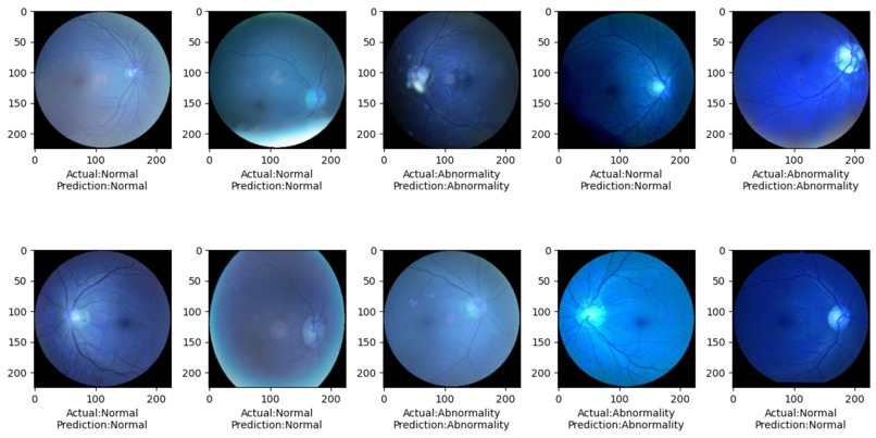 Ocular Disease Prediction – screenshot 1