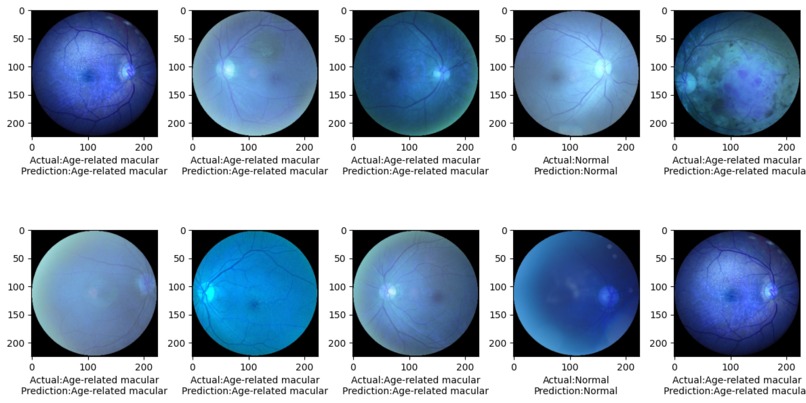 Ocular Disease Prediction – screenshot 2