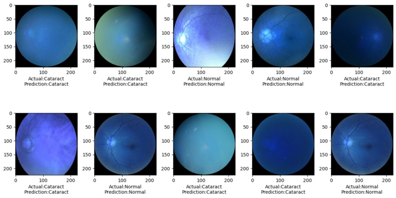 Ocular Disease Prediction – screenshot 3