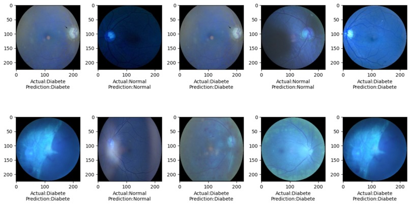 Ocular Disease Prediction – screenshot 4