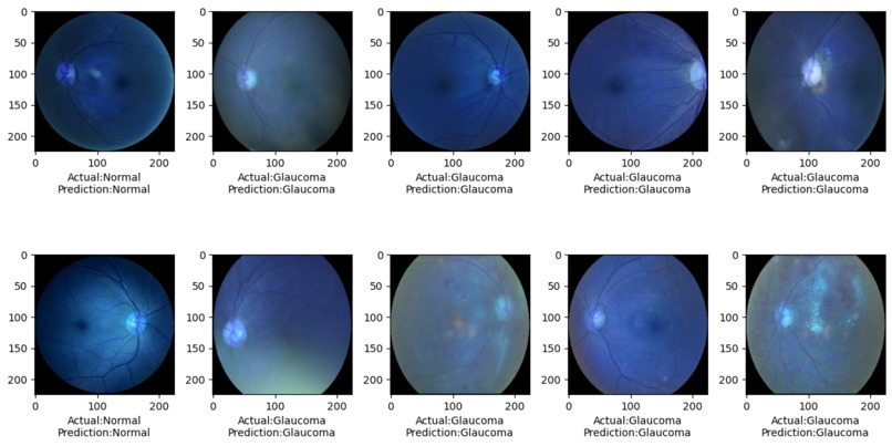 Ocular Disease Prediction – screenshot 5