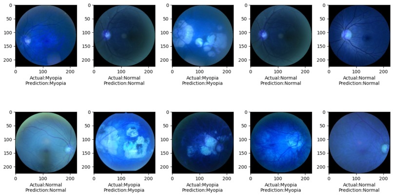 Ocular Disease Prediction – screenshot 6