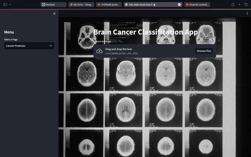 Finding Cancer From X-Ray Images – screenshot 1