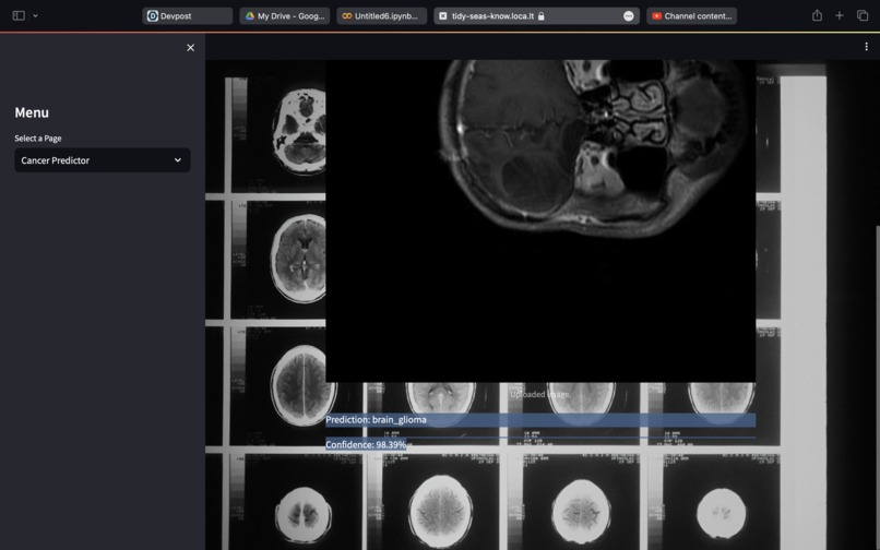 Finding Cancer From X-Ray Images – screenshot 2