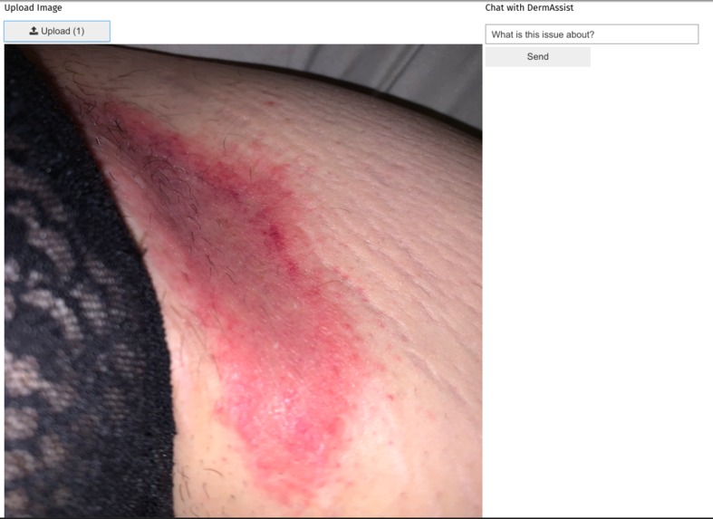 DermAssist: the Future of Skinformatics – screenshot 1