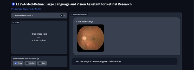 LLaVA-Med-Retina – screenshot 1