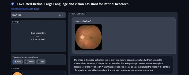 LLaVA-Med-Retina – screenshot 2