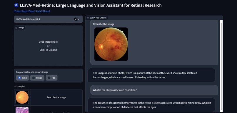 LLaVA-Med-Retina – screenshot 3