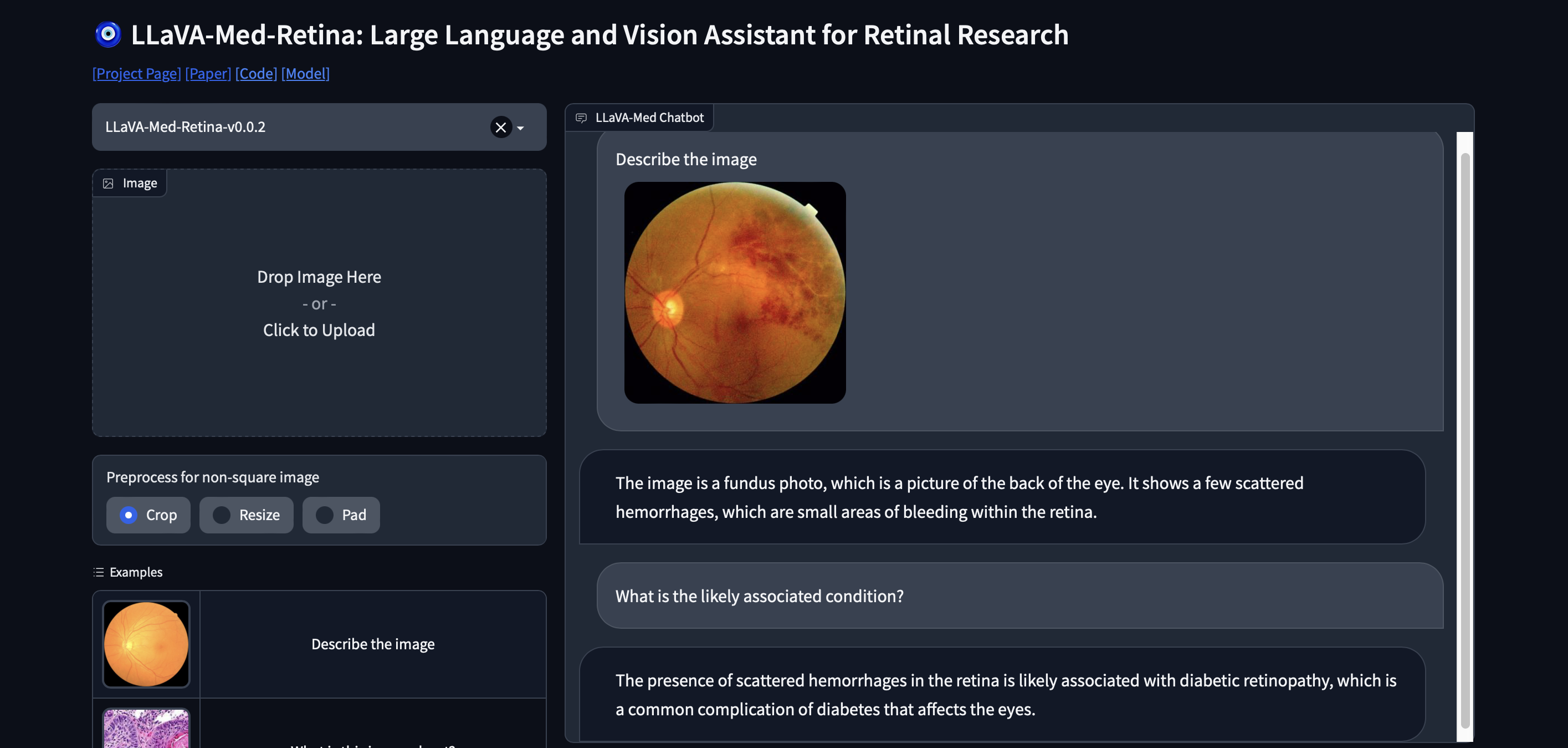 LLaVA-Med-Retina | Devpost
