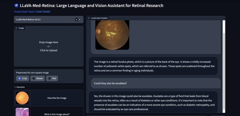 LLaVA-Med-Retina – screenshot 5