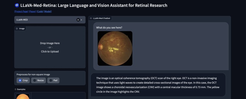 LLaVA-Med-Retina – screenshot 6