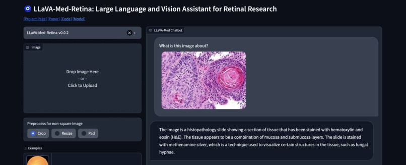 LLaVA-Med-Retina – screenshot 7