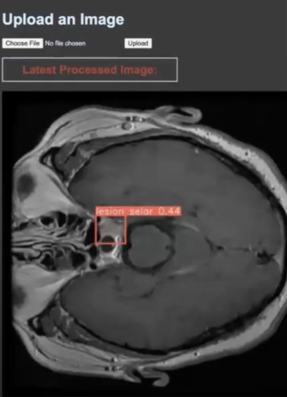 RoboRadiology: AI Driven X-Ray Diagnostics – screenshot 1