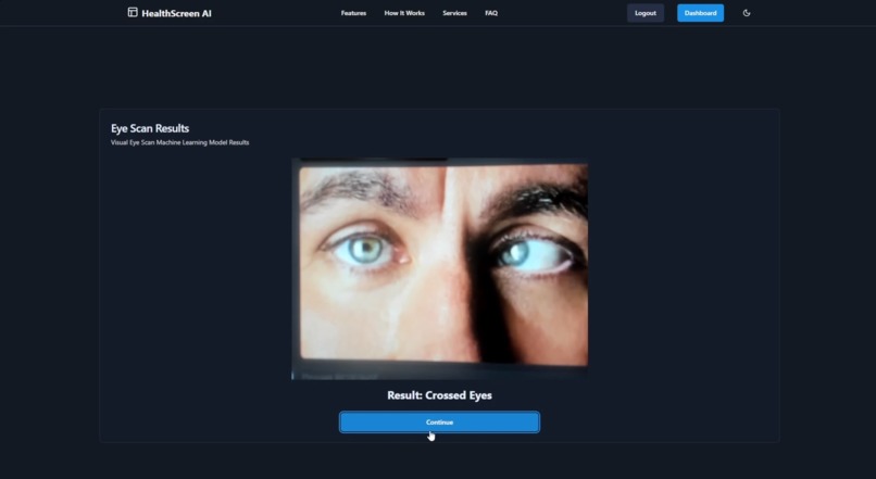 HealthScreen AI – screenshot 4