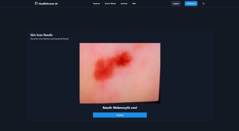 HealthScreen AI – screenshot 6