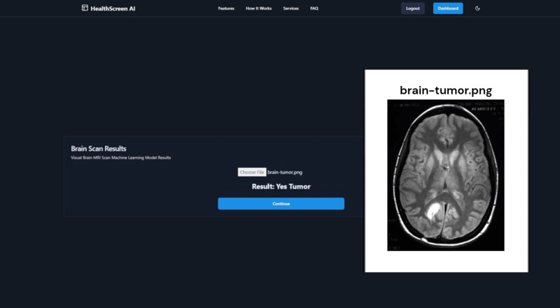 HealthScreen AI – screenshot 7