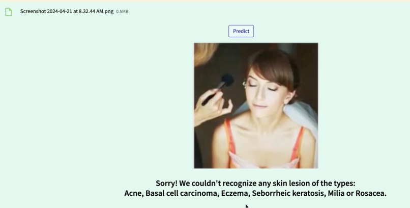 SkinScan AI – screenshot 3